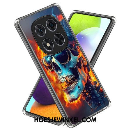 Hoesje Voor Xiaomi Redmi Note 14 Pro 4g Vlammende Schedel